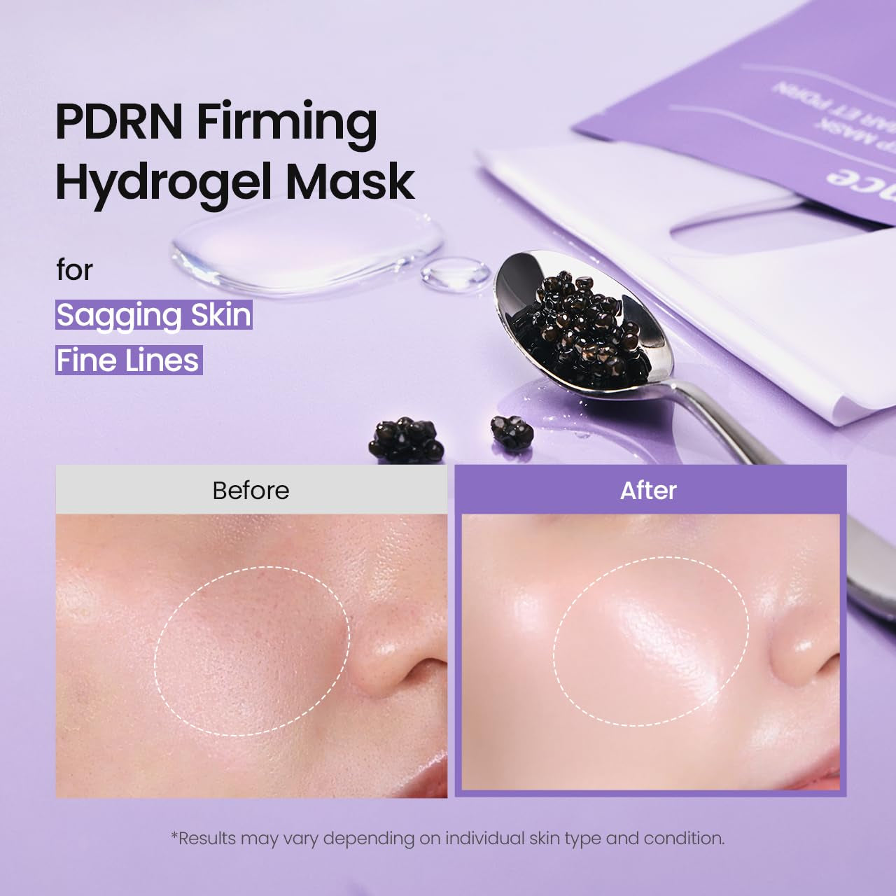 Rejuvenating Caviar PDRN Real Deep Mask, Overnight Hydrogel Face Mask, Skin Firming, Radiance, Enhancing Skin Recovery, Korean Skin Care, Mothers Day Gifts | 1.19Oz(34G) X 4Ea