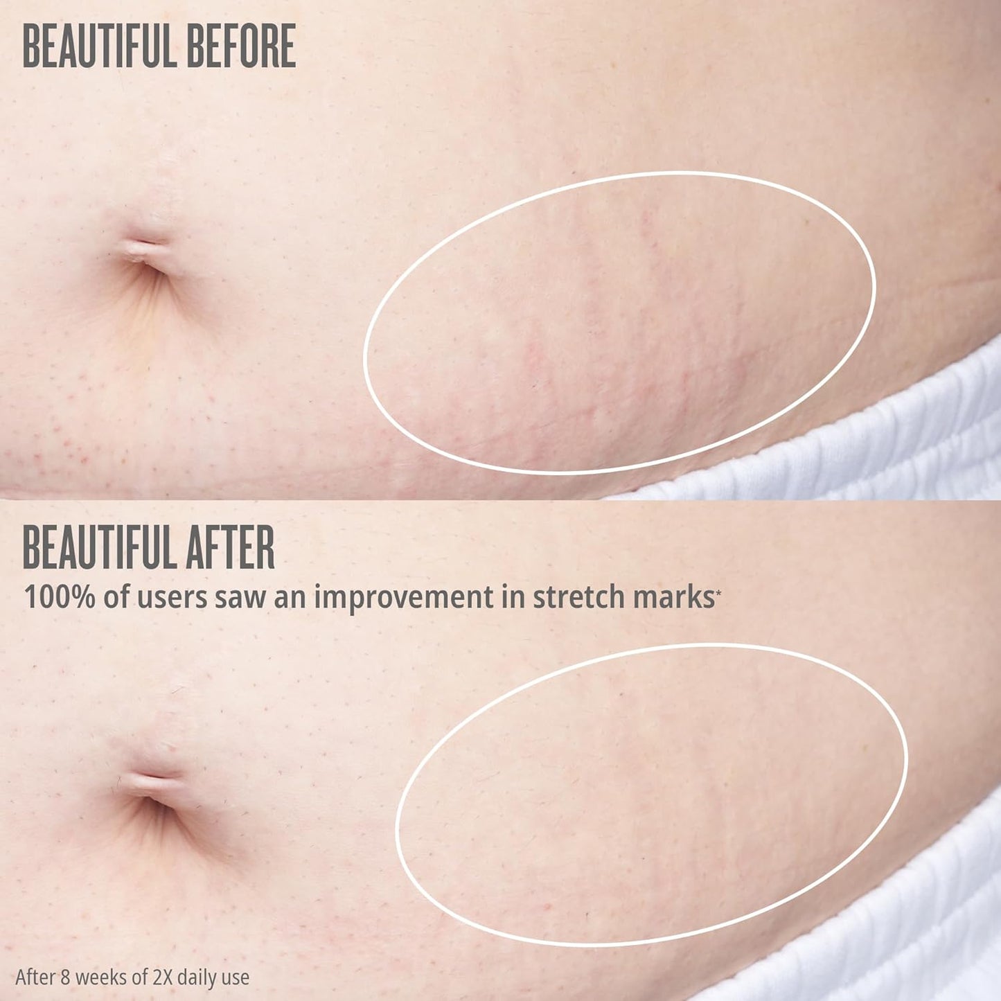 Bum Bum Firmeza Body Oil - Stretch Mark Oil