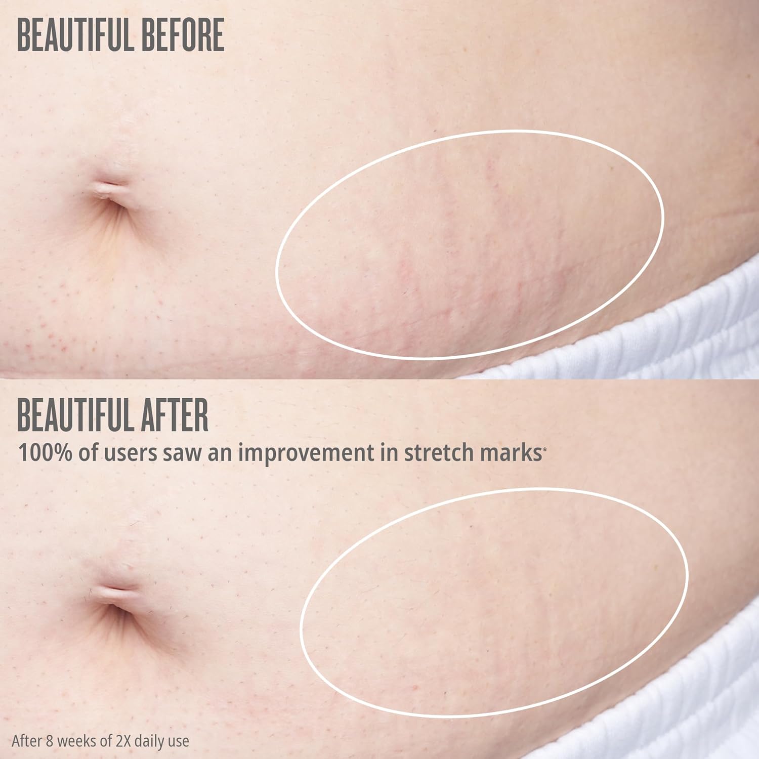 Bum Bum Firmeza Body Oil - Stretch Mark Oil