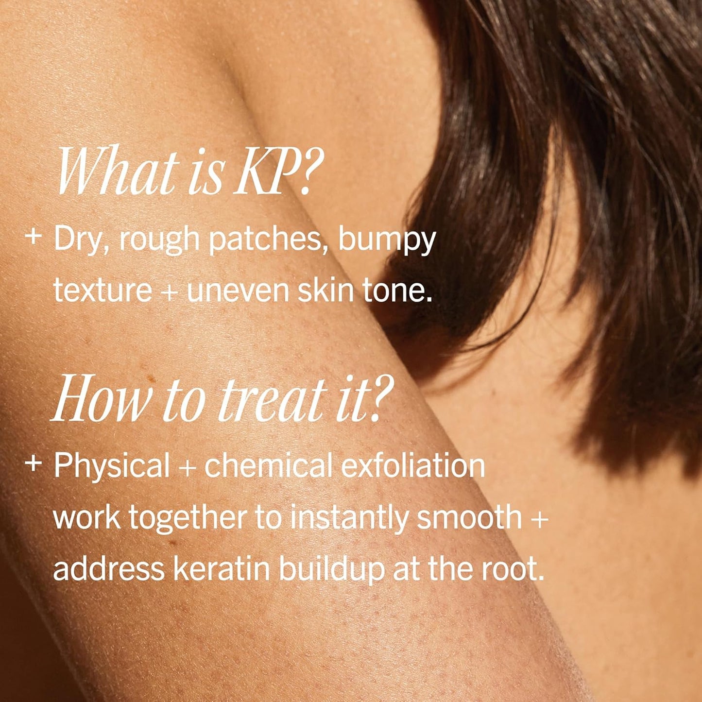 KP Bump Eraser Body Scrub with 10% AHA, Keratosis Pilaris Skin Exfoliator with Glycolic and Lactic Acids