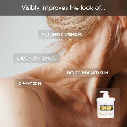 Retinol Body Lotion & Face Moisturizer | Visible anti Aging Skin Care Retinol Body Cream for Women & Men Targets Look of Fine Lines, Wrinkles, & Crepe Looking Dry Skin, 16 Ounce