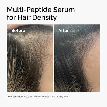 The Ordinary Multi-Peptide Serum for Hair Density, Peptide-Powered Formula for Thicker, Fuller Looking Hair