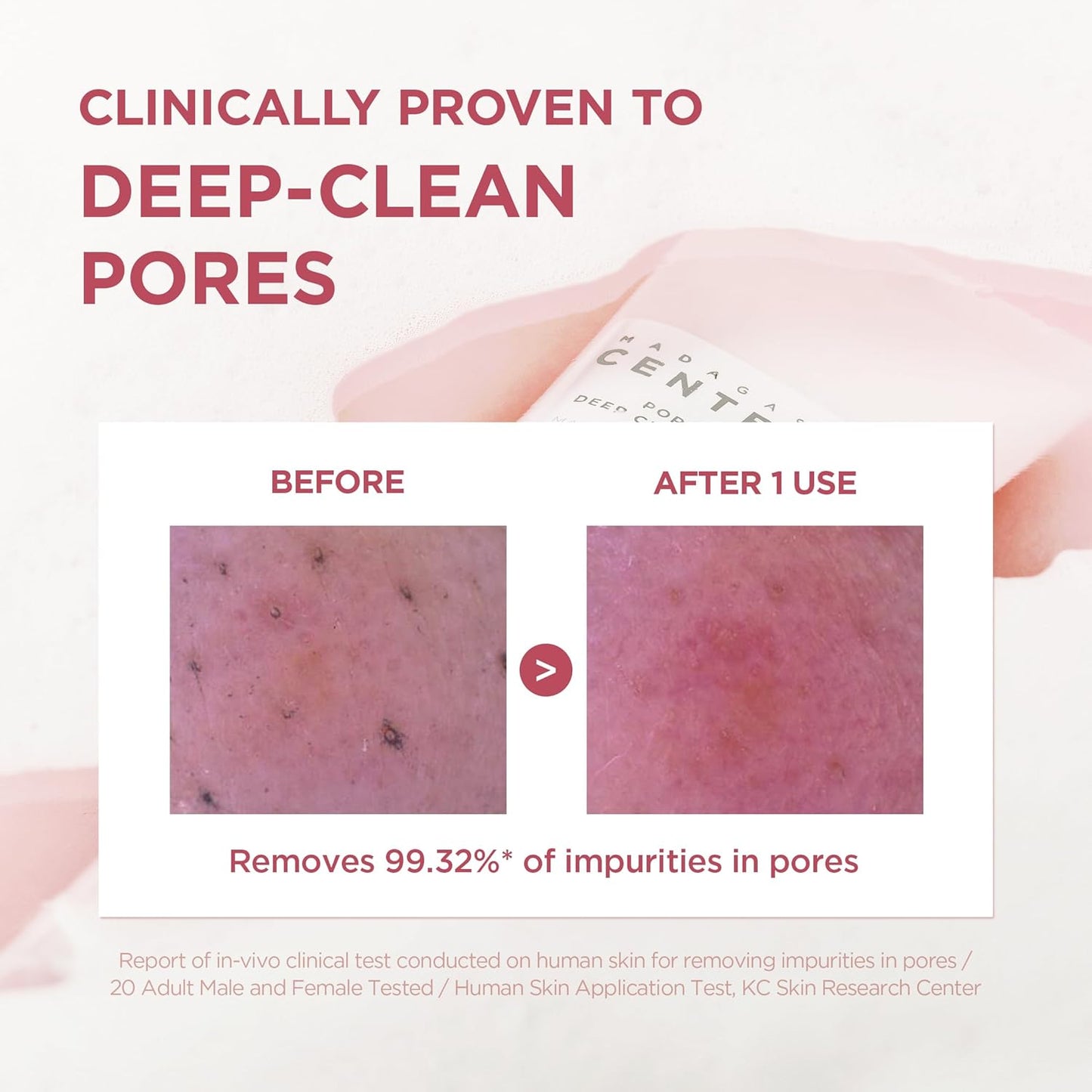 Poremizing Deep Cleansing Foam, 4.23 Fl.Oz, 125Ml, Makeup Remover, Korean Face Cleanser with Himalayan Pink Salt & Madagascar Centella Asiatica for Facial Pore Cleansing, Korean Skin Care